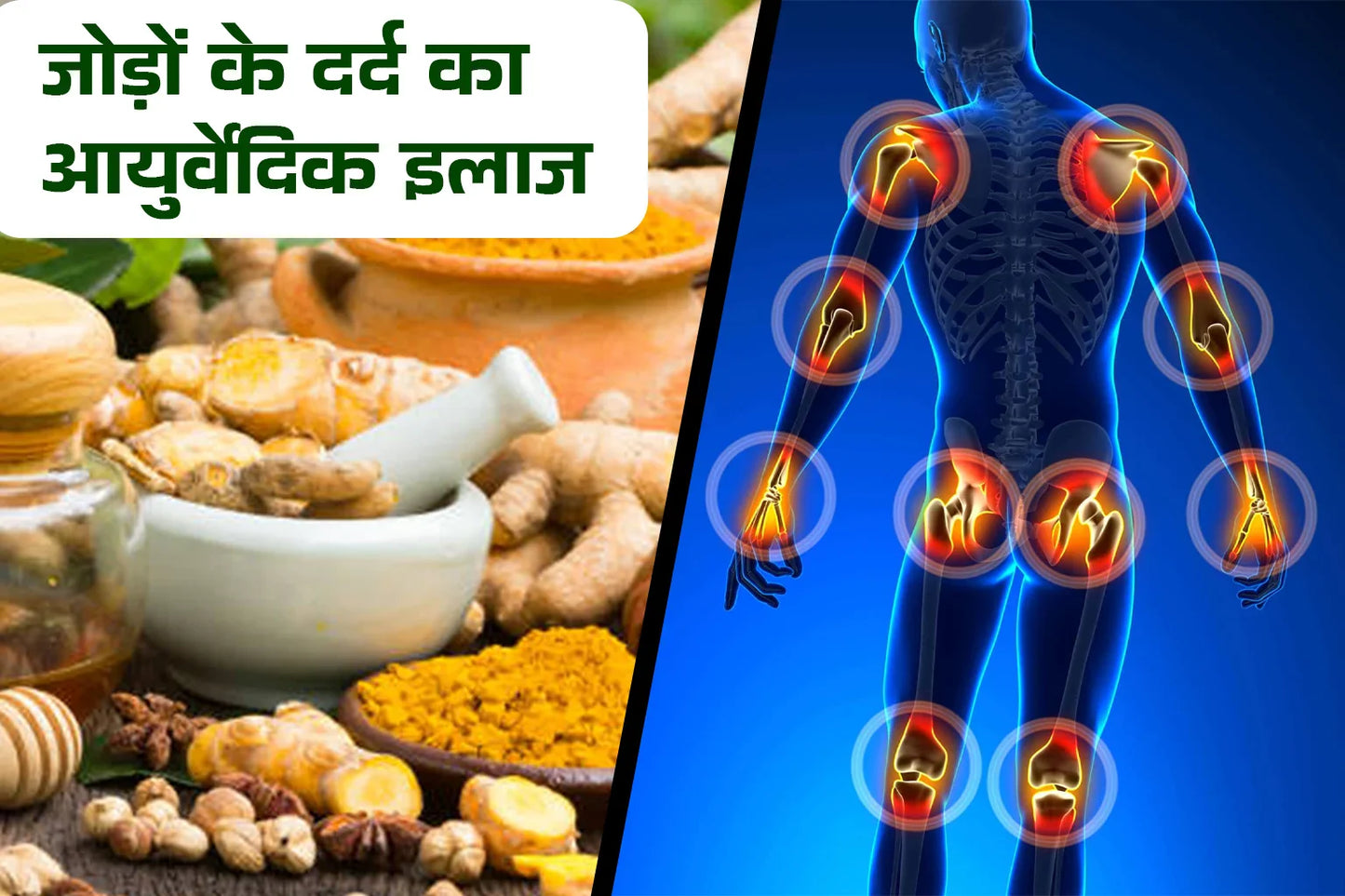 जोड़ों के दर्द का आयुर्वेदिक इलाज